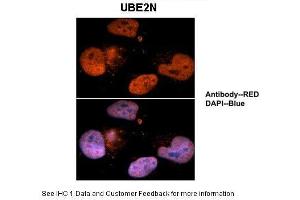 Sample Type :  Human brain stem cells  Primary Antibody Dilution :  1:500  Secondary Antibody :  Goat anti-rabbit Alexa-Fluor 594  Secondary Antibody Dilution :  1:1000  Color/Signal Descriptions :  UBE2N: Red DAPI:Blue  Gene Name :  UBE2N  Submitted by :  Dr. (UBE2N antibody  (Middle Region))