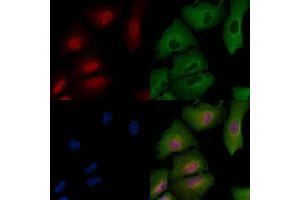 anti-FGFR1, FGFR2 (pTyr463), (pTyr466) antibody