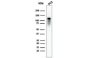 Western Blotting (WB) image for anti-Drebrin 1 (DBN1) (AA 150-281) antibody (ABIN6939227)