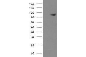 HEK293T cells were transfected with the pCMV6-ENTRY control (Left lane) or pCMV6-ENTRY ZBED1 (Right lane) cDNA for 48 hrs and lysed. (ZBED1 antibody)