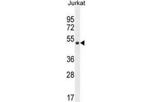 SNIP1 Antibody (N-term) western blot analysis in Jurkat cell line lysates (35µg/lane). (SNIP1 antibody  (N-Term))