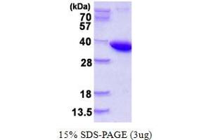 SDS-PAGE (SDS) image for Pyrophosphatase (Inorganic) 1 (PPA1) (AA 1-289) protein (His tag) (ABIN667664) (Pyrophosphatase (Inorganic) 1 (PPA1) (AA 1-289) protein (His tag))
