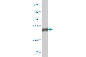 Western Blot detection against Immunogen (37. (ART3 antibody  (AA 29-138))