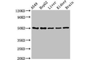 Western Blot Positive WB detected in: A549 whole cell lysate, HepG2 whole cell lysate, Mouse liver tissue, Mouse kidney tissue, Mouse brain tissue All lanes: SLC33A1 antibody at 2. (SLC33A1 antibody  (AA 1-74))