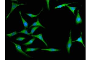 Immunofluorescence staining of Hela cells with ABIN6999591 at 1:100, counter-stained with DAPI. (MX2 antibody  (AA 548-688))
