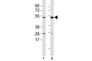 Western blot testing of Mlkl antibody at 1:1000 dilution and mouse samples: (1) lung, (2) spleen lysate