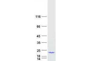 Acid Phosphatase 1, Soluble (ACP1) (Transcript Variant 3) protein (Myc-DYKDDDDK Tag)