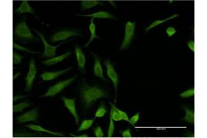 Immunofluorescence of monoclonal antibody to OXSR1 on HeLa cell. (OXSR1 antibody  (AA 351-450))