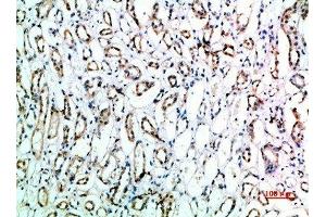 Immunohistochemical analysis of paraffin-embedded human-kidney, antibody was diluted at 1:200 (CD151 antibody  (AA 91-140))