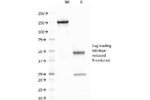 SDS-PAGE Analysis Purified CELA3B Mouse Monoclonal Antibody (CELA3B/1758).