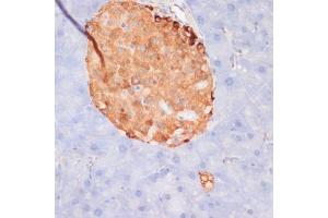 Immunohistochemistry of paraffin-embedded mouse pancreas using Phospho-ACLY-S455 antibody (ABIN6135178, ABIN6136002, ABIN6136003 and ABIN6225678) at dilution of 1:100 (40x lens). (ACLY antibody  (pSer455))