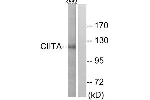 Western blot analysis of extracts from K562 cells, using CIITA antibody. (CIITA antibody  (Internal Region))