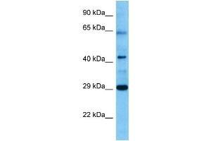 Host:  Mouse  Target Name:  VDR  Sample Tissue:  Mouse Pancreas  Antibody Dilution:  1ug/ml (Vitamin D Receptor antibody  (N-Term))