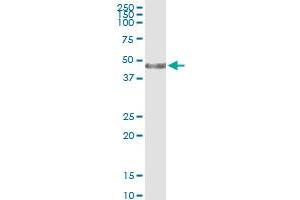 Immunoprecipitation of KRT34 transfected lysate using anti-KRT34 MaxPab rabbit polyclonal antibody and Protein A Magnetic Bead , and immunoblotted with KRTHA4 MaxPab mouse polyclonal antibody (B01) . (Keratin 34 antibody  (AA 1-436))
