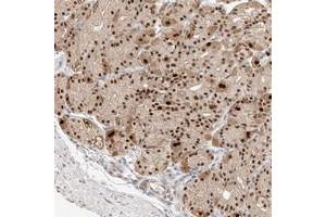 Immunohistochemical staining of human stomach with APIP polyclonal antibody  shows strong nuclear positivity in glandular cells. (APIP antibody)