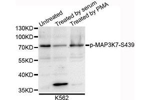 Western blot analysis of extracts of K562 cells, using Phospho-MAP3K7-S439 antibody. (MAP3K7 antibody  (pSer412))