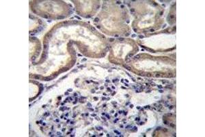 STIM2 antibody immunohistochemistry analysis in formalin fixed and paraffin embedded human kidney tissue. (Stim2 antibody  (AA 98-127))