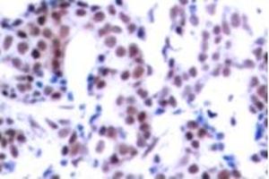 Image no. 2 for anti-Jun B Proto-Oncogene (JUNB) (pSer259) antibody (ABIN318057) (JunB antibody  (pSer259))