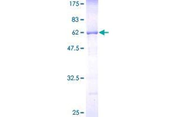 CNOT7 Protein (AA 1-285) (GST tag)