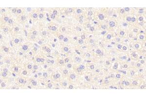 Detection of NT in Mouse Liver Tissue using Polyclonal Antibody to Neurotensin (NT) (Neurotensin antibody  (AA 42-167))