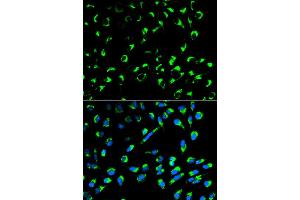 Immunofluorescence analysis of MCF-7 cells using SFN antibody. (14-3-3 sigma/SFN antibody)