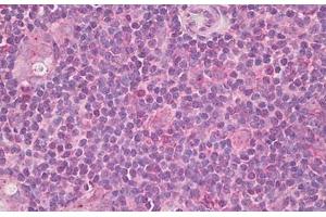 Image no. 1 for anti-Inducible T-Cell Co-Stimulator Ligand (ICOSLG) (AA 197-246) antibody (ABIN6749802) (ICOSLG antibody  (AA 197-246))