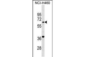Western blot analysis in NCI-H460 cell line lysates (35ug/lane). (PET112L antibody  (N-Term))