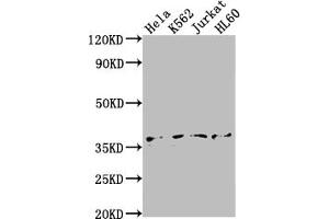 Western Blot Positive WB detected in: Hela whole cell lysate, K562 whole cell lysate, Jurkat whole cell lysate, HL60 whole cell lysate All lanes: TBP antibody at 1:2000 Secondary Goat polyclonal to rabbit IgG at 1/50000 dilution Predicted band size: 38, 36 kDa Observed band size: 36 kDa (Recombinant TBP antibody)