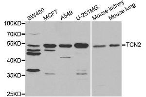 Western blot analysis of extracts of various cell lines, using TCN2 antibody. (TCN2 antibody)