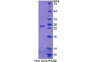 Image no. 1 for WAP Four-Disulfide Core Domain 1 (WFDC1) (AA 24-208) protein (His tag) (ABIN4988814)