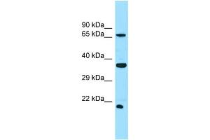 WB Suggested Anti-SLC13A1 Antibody Titration: 1. (SLC13A1 antibody  (N-Term))