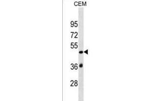 SP140L Antibody (Center) (ABIN1537899 and ABIN2849879) western blot analysis in CEM cell line lysates (35 μg/lane). (SP140L antibody  (AA 158-185))