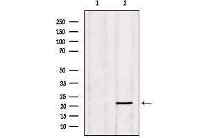 Western blot analysis of extracts from Hela, using PGRMC1 Antibody.
