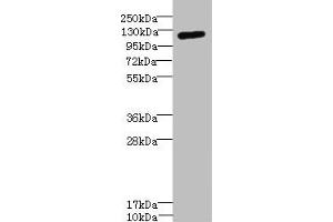 Western blot All lanes: ITGAXantibody IgG at 1. (CD11c antibody  (AA 100-350))