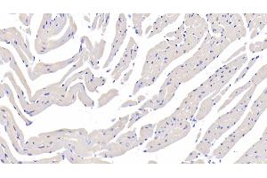 Detection of FUCa1 in Mouse Cardiac Muscle Tissue using Polyclonal Antibody to Fucosidase Alpha L1, Tissue (FUCa1) (FUCA1 antibody  (AA 185-447))