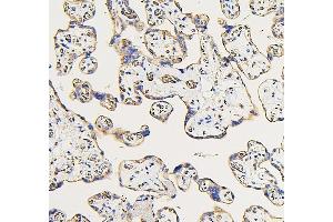 IHC analysis of IFNAR2 using anti-IFNAR2 antibody (ABIN7601353). (IFNAR2 antibody  (AA 33-466))