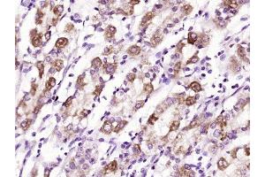 Paraformaldehyde-fixed, paraffin embedded human stomach tissue, Antigen retrieval by boiling in sodium citrate buffer (pH6. (Glucagon Receptor antibody  (AA 11-110))