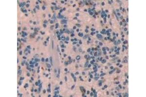 #VALUE! (IFNA11 antibody  (AA 24-190))