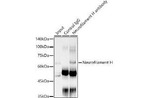 Immunoprecipitation analysis of 300 μg extracts of PC-3 cells using 3 μg Neurofilament H antibody (ABIN7268866).
