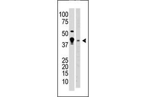 The anti-MBD2 N-term Antibody (ABIN387915 and ABIN2844333) is used in Western blot to detect MBD2 in  cell lysate (lane 1) and mouse brain tissue lysate (lane 2) lysate. (MBD2 antibody  (AA 120-151, AA 120-152))