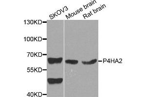 Western blot analysis of extract of various cells, using P4HA2 antibody. (P4HA2 antibody)