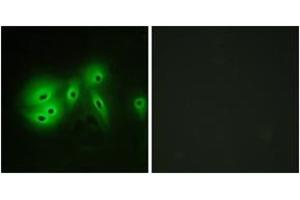 Immunofluorescence analysis of A549 cells, using ADCY8 Antibody. (ADCY8 antibody  (AA 591-640))