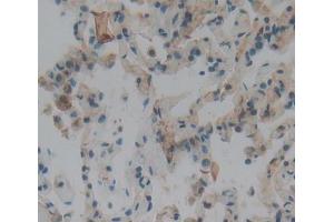 #VALUE! (Olfactomedin 3 antibody  (AA 24-198))