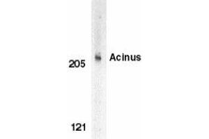 Western blot analysis of Acinus in K562 whole cell lysate with Acinus antibody at 1 μg/ml. (ACIN1 antibody)
