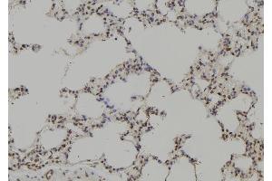 ABIN6265073 and ABIN6269204 at 1/100 staining Rat lung tissue by IHC-P.