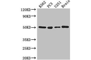 Western Blot Positive WB detected in: K562 whole cell lysate, PC-3 whole cell lysate, U251 whole cell lysate, Mouse brain tissue All lanes: TUBA1C antibody at 3 μg/mL Secondary Goat polyclonal to rabbit IgG at 1/50000 dilution Predicted band size: 50 kDa Observed band size: 50 kDa (TUBA1C antibody  (AA 29-184))