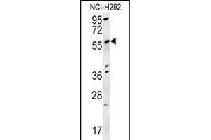 STA18 Antibody (N-term) (ABIN657881 and ABIN2846836) western blot analysis in NCI- cell line lysates (15 μg/lane).