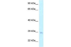 WB Suggested Anti-MTG1 Antibody Titration: 1. (MTG1 antibody  (Middle Region))