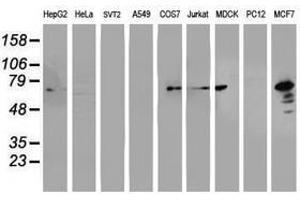 Image no. 3 for anti-Protein Disulfide Isomerase Family A, Member 4 (PDIA4) antibody (ABIN1500108) (PDIA4 antibody)
