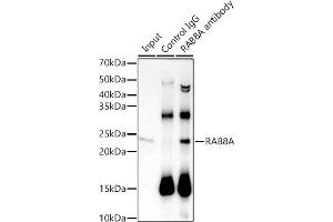 Immunoprecipitation analysis of 600 μg extracts of Mouse brain cells using 3 μg RA antibody (ABIN7269814). (RAB8A antibody)